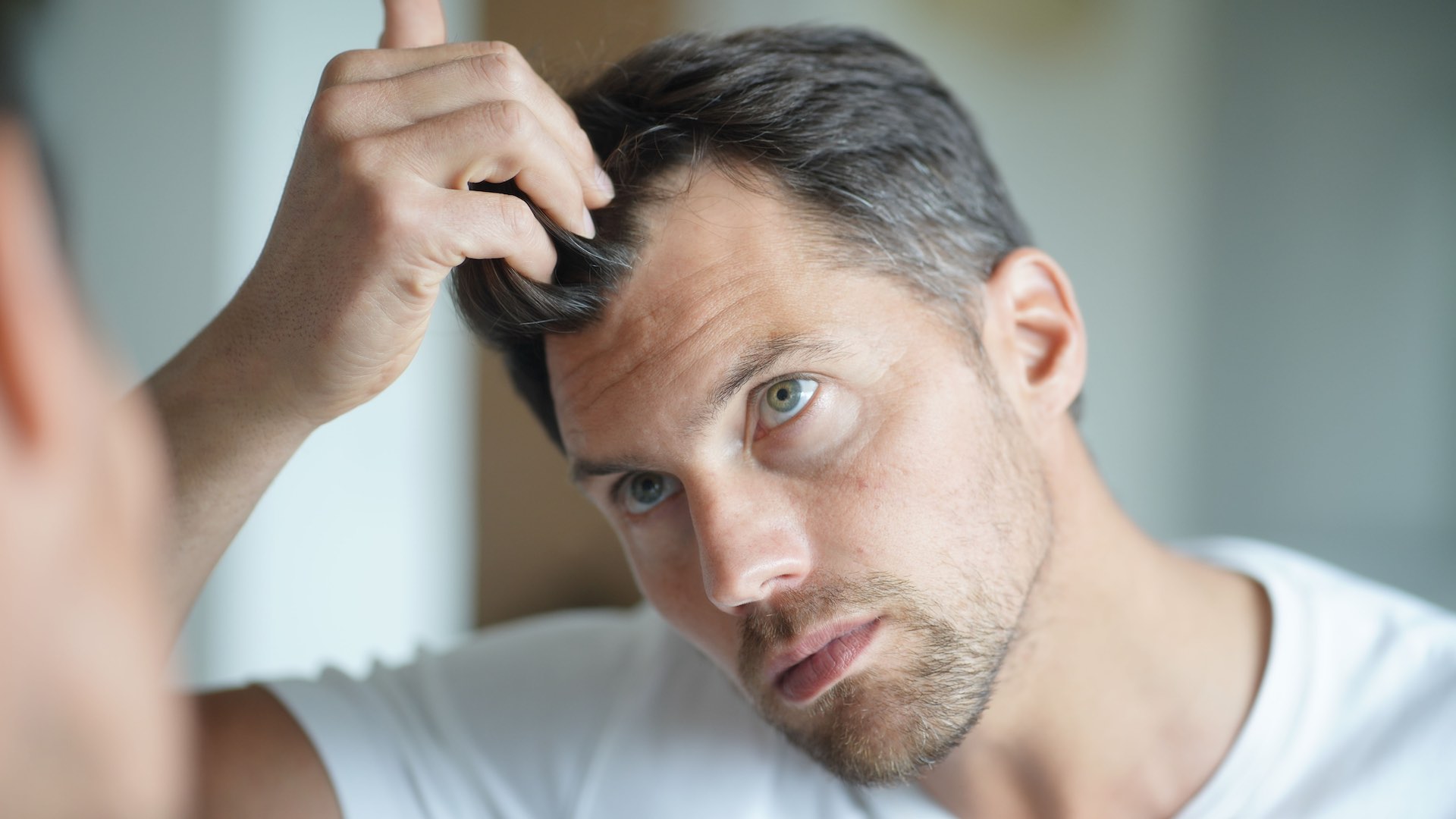 Perte de cheveux chez les hommes, inquiétant?